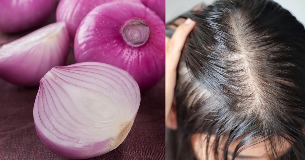 Onion Oil: प्याज का रस बालों के लिए है काफी फायदेमंद, ऐसे करें इस्तेमाल