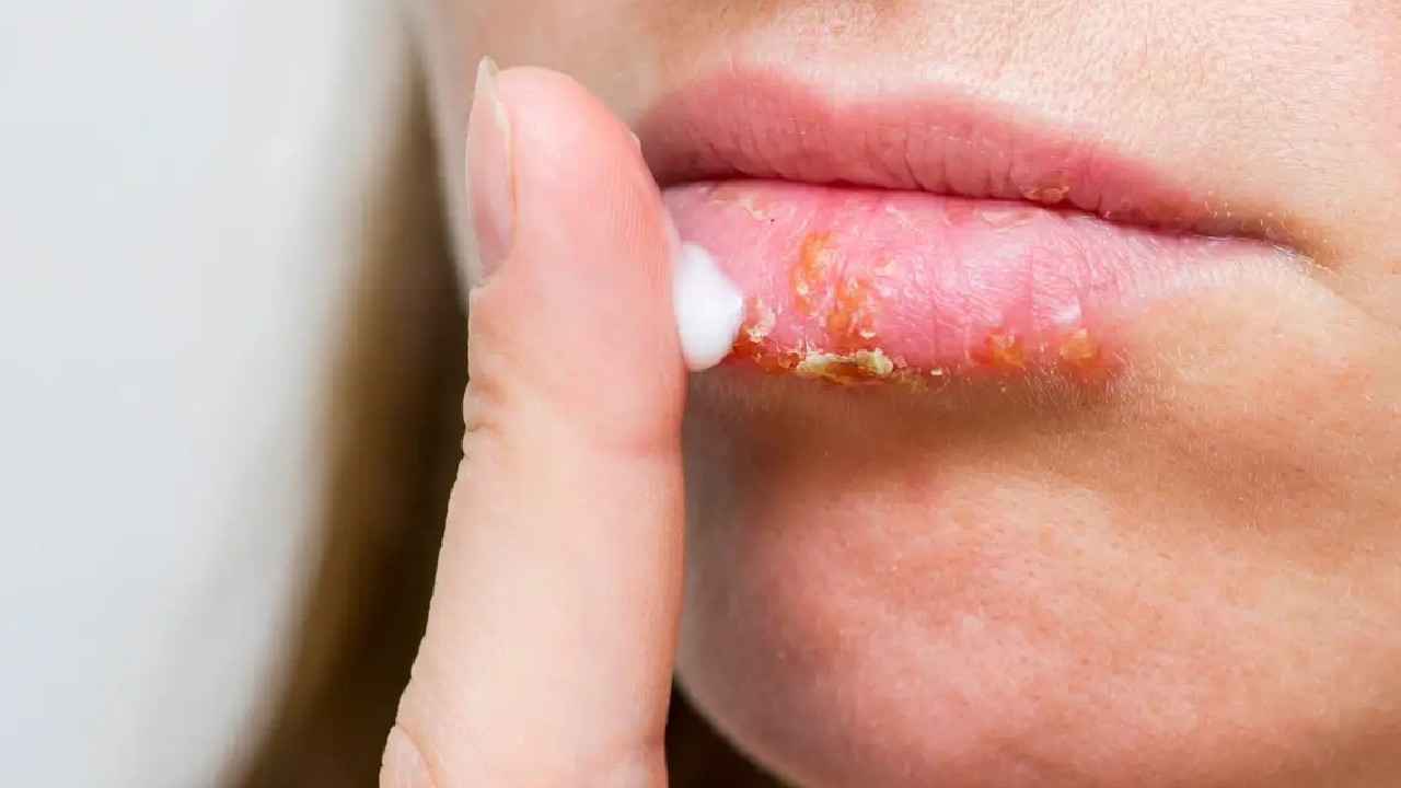 Dry Lips: सर्दियों में फटने लगे होठ तो करें इन घरेलू नुस्खे का प्रयोग, होठ क्रीम की तरह रहेगें मुलायम