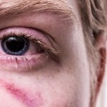 Eye Care: क्या है मैक्यूलर एडिमा और उसके लक्षण, इससे बचने के लिए करें ये उपाय