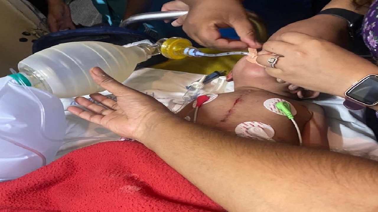 Surgery In Flight : देवदूत बने AIIMS के डॉक्टर्स, फ्लाइट में सर्जरी कर बचाई बच्ची की जान