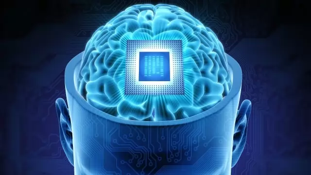 Neuralink First human implant 