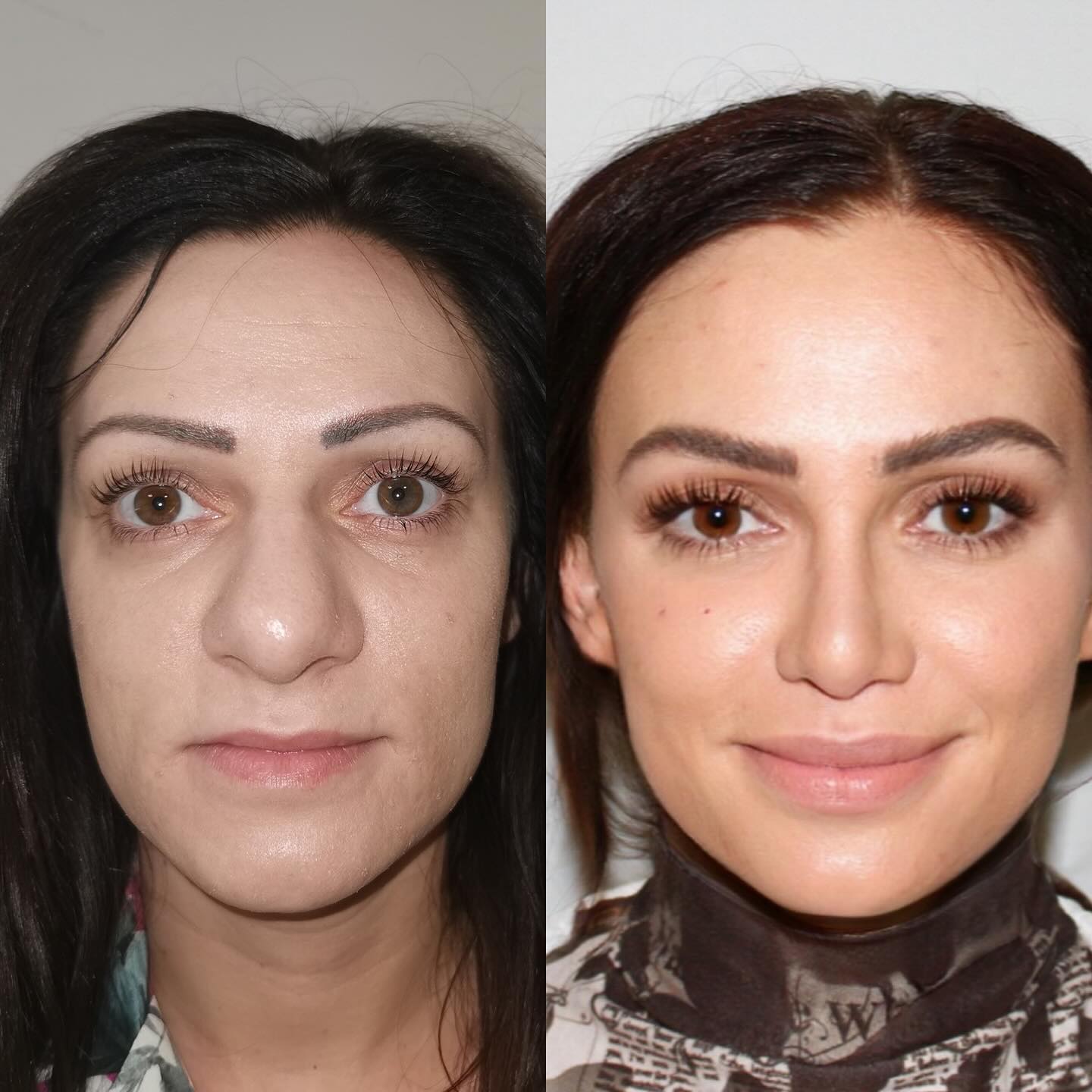 Image Before and After Surgery