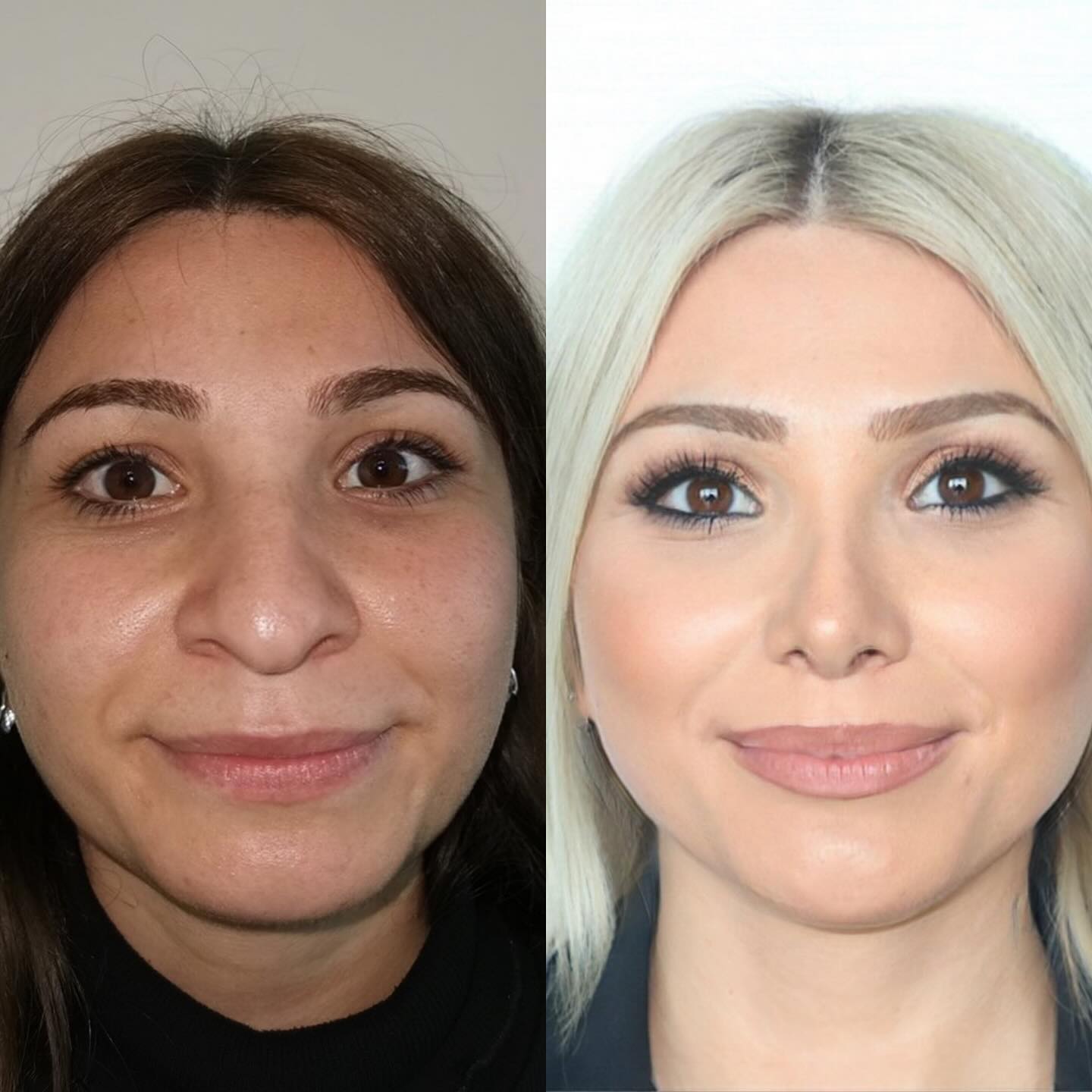 Image Before and After Surgery